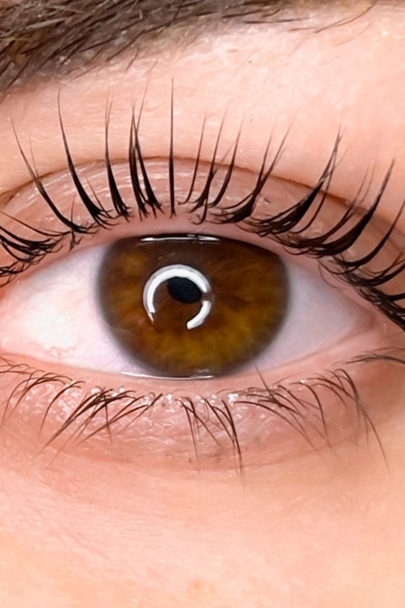 Depilacja Laserowa w Gdańsku