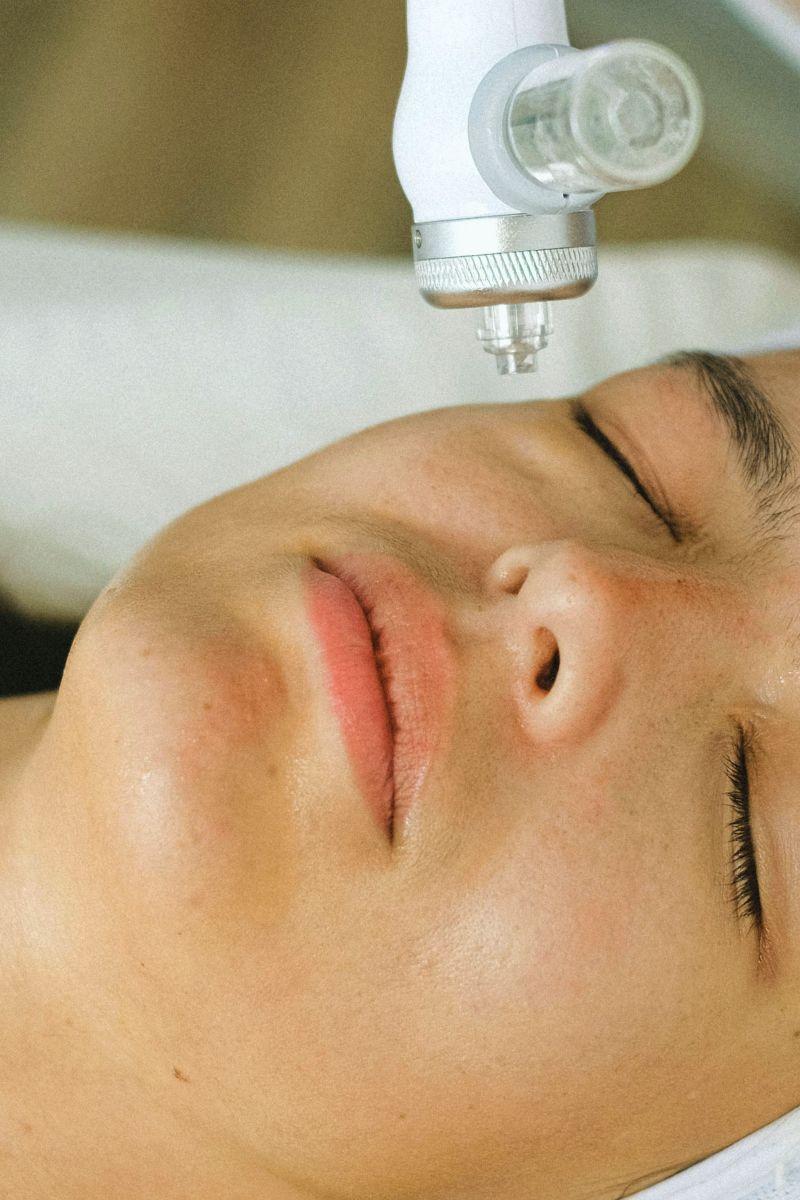 Depilacja Laserowa w Gdańsku